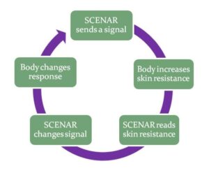 SCENAR (SCENAR) Biofeedback mechanism