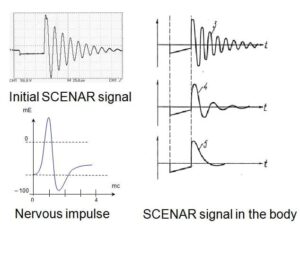 SCENAR signal dynamically changes in the body